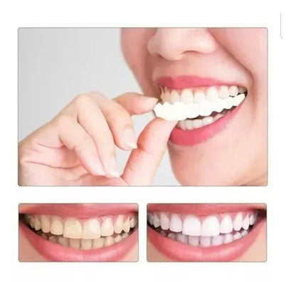 2pcs Carillas Dientes Postizos De Sonrisa Superior Inferior